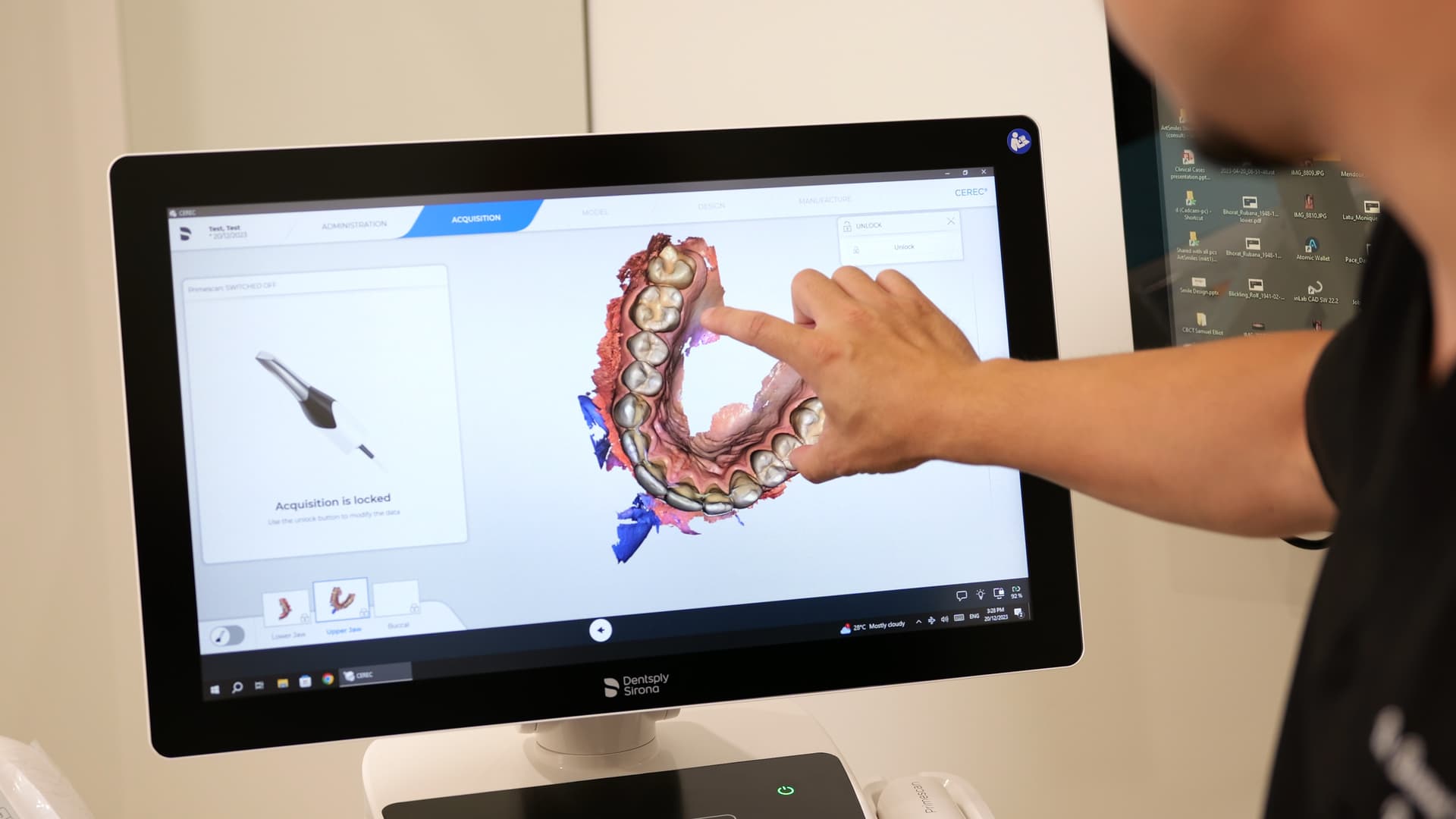 Digital smile design consultation at ArtSmiles