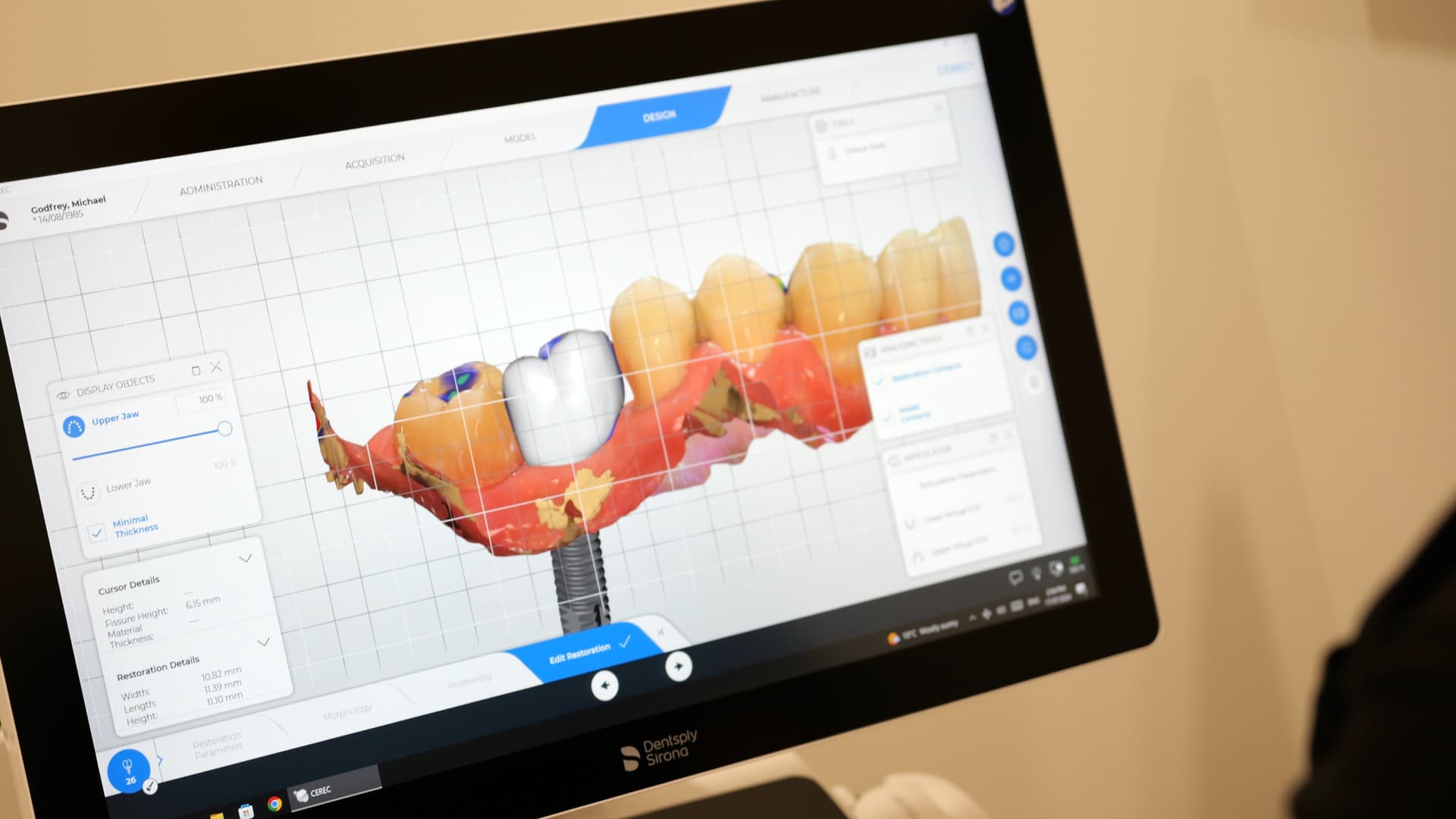 Bone and Structural Assessment