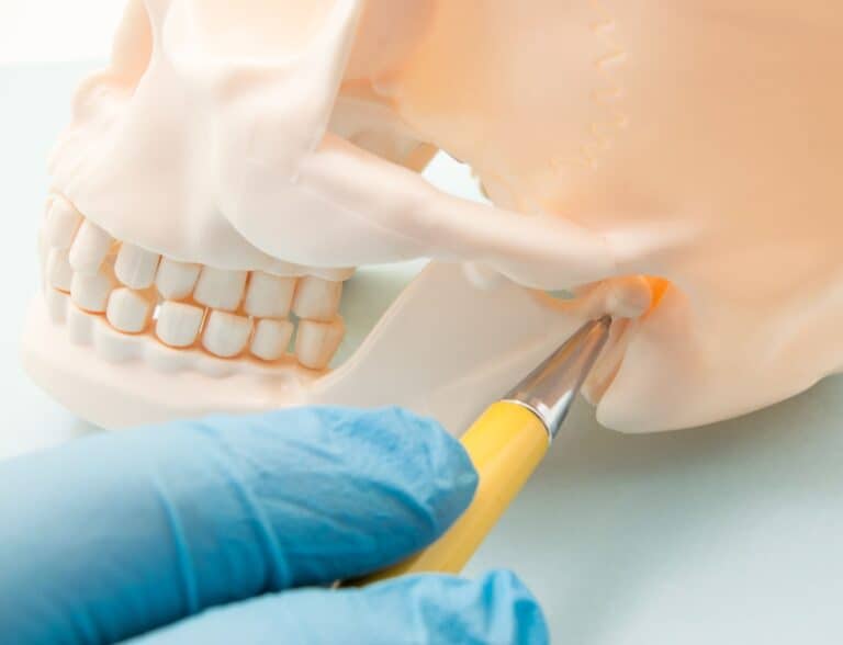 Dentist pointing TMJ on a Skull