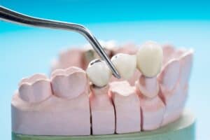 prosthodontics prosthetic