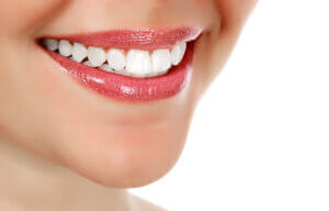 Close up smile woman white pearly teeth