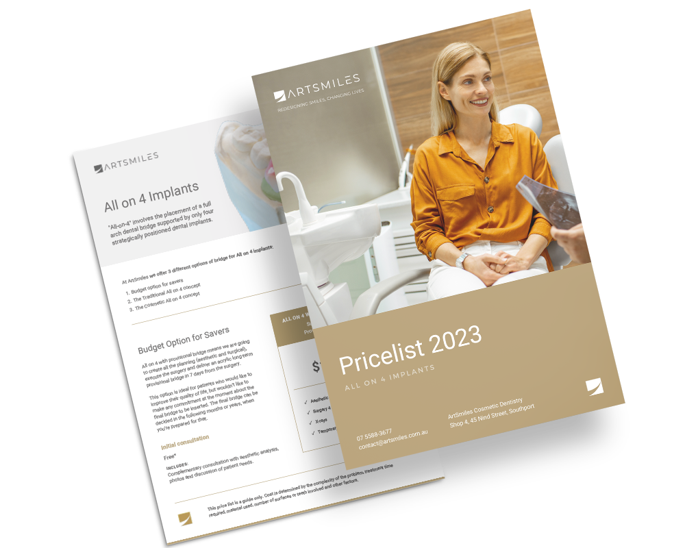 Dental Implants Pricelist Mock 5