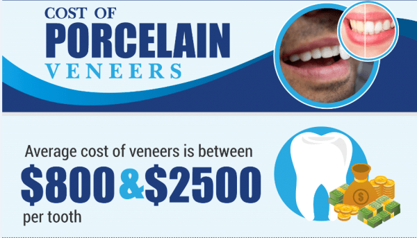 Cost of Veneers Infographic