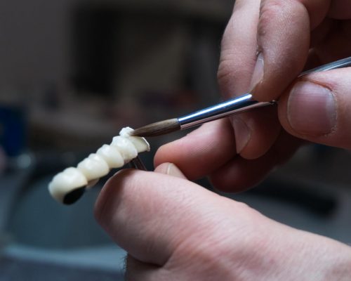 dental technician creates dental prostheses. laboratory. close-up